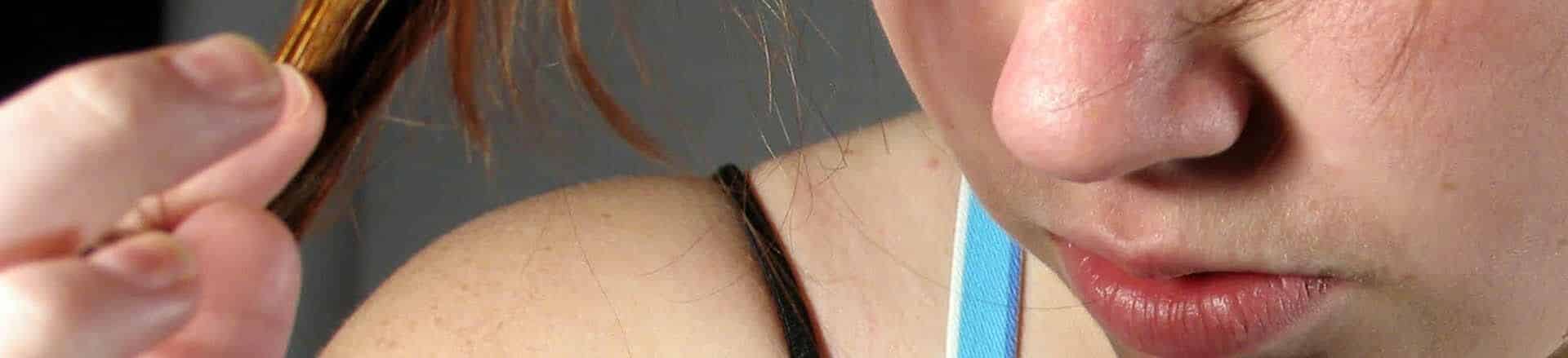 What causes sudden hair loss in women?