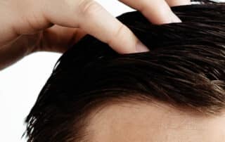 Celebrities Hair Transplants - Growing List of Celebrities