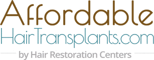 Affordable Hair Transplants Logo