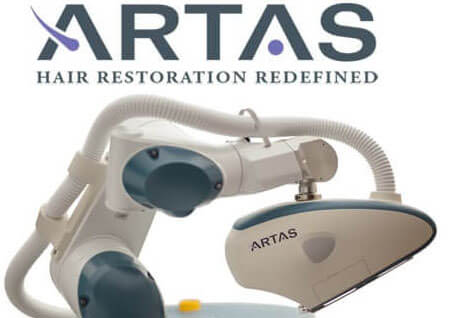 robotic hair transplant - artas hair restoration