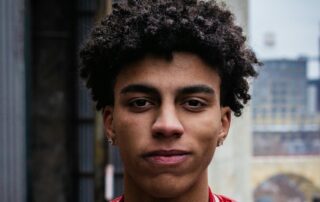 Hair Transplant for Afro