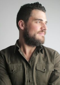 What should I expect during the beard transplant surgery_ 2 beard shaping hair transplant