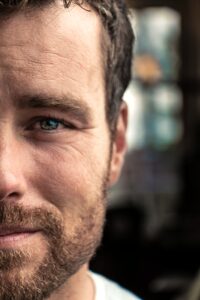 adult-blur-close-up-167669 Hair Transplant Trends